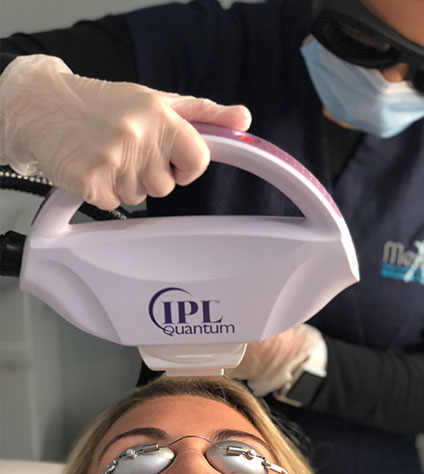 red vein treatment