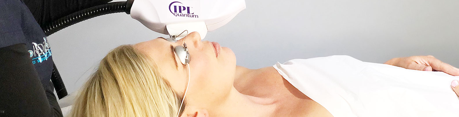 red vein treatment spider veins