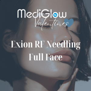 Exion RF Needling Full Face