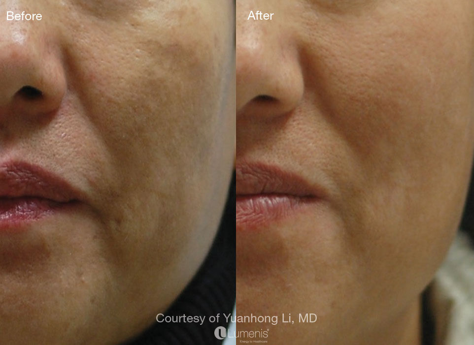 Pigmentation_65.jpg