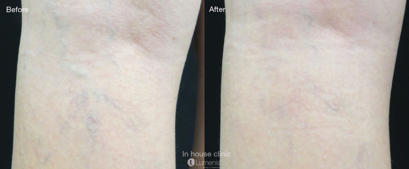 Vascular_60.jpg